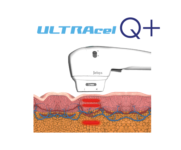 ULTRAcel Q+